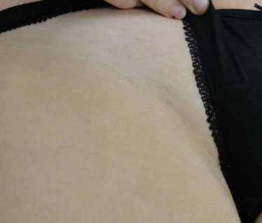 Efter
